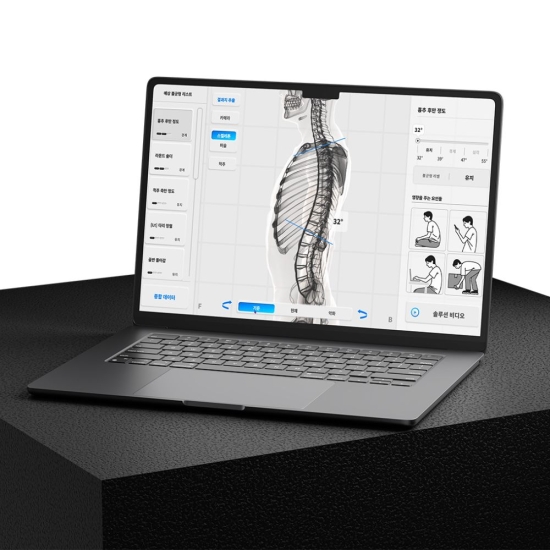 Moti Physio 2  - analiza postawy i ruchu w technologii 3D